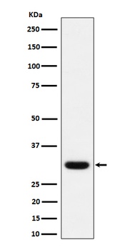 Adiponectin Rabbit Monoclonal Antibody