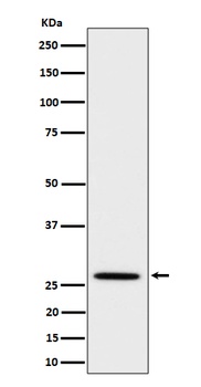Anti-Adiponectin Rabbit Monoclonal Antibody