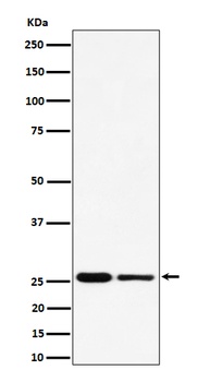 PMF1 Rabbit Monoclonal Antibody