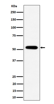 Anti-PPP2R5E Rabbit Monoclonal Antibody