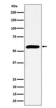 PRPF4 Rabbit Monoclonal Antibody