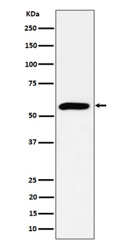 Anti-PRPF4 Rabbit Monoclonal Antibody