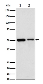 Annexin A7 Rabbit Monoclonal Antibody