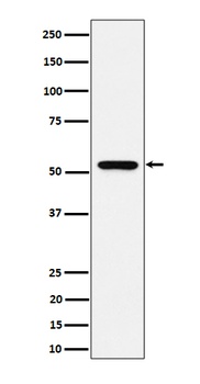 GRSF1 Rabbit Monoclonal Antibody