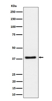 UCHL5IP Rabbit Monoclonal Antibody
