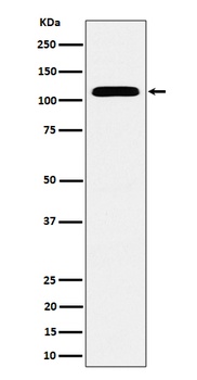 Anti-SEC24D Rabbit Monoclonal Antibody