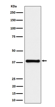 UCHL5IP Rabbit Monoclonal Antibody