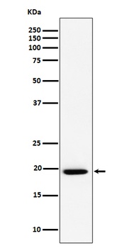 Anti-UFC1 Rabbit Monoclonal Antibody