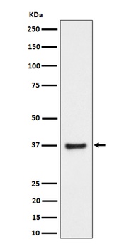 RNF115 Rabbit Monoclonal Antibody