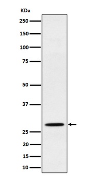 Anti-PSMB10 Rabbit Monoclonal Antibody
