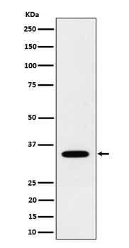 Anti-NTH1 Rabbit Monoclonal Antibody