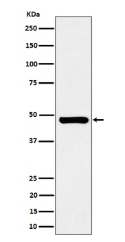 Anti-SNX5 Rabbit Monoclonal Antibody