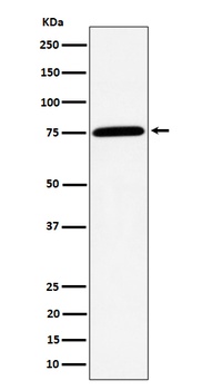 Anti-PPM1G Rabbit Monoclonal Antibody