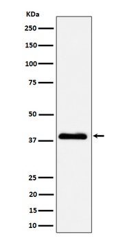 NSDHL Rabbit Monoclonal Antibody