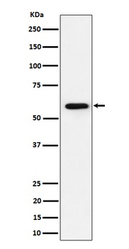 Anti-PRPF31 Rabbit Monoclonal Antibody