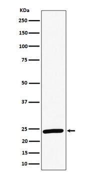 Anti-RAB8A Rabbit Monoclonal Antibody