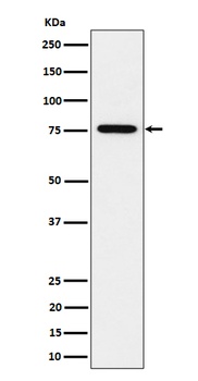Anti-BRAT1 Rabbit Monoclonal Antibody