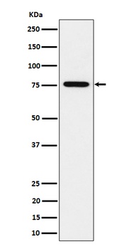 BRAT1 Rabbit Monoclonal Antibody