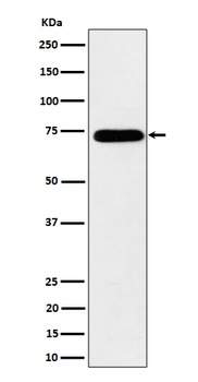 HNRNPM Rabbit Monoclonal Antibody