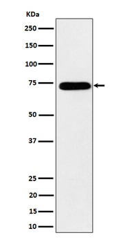 Anti-HNRNPM Rabbit Monoclonal Antibody
