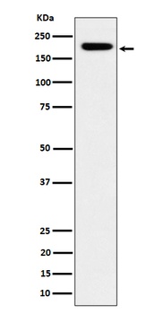 Anti-IQGAP2 Rabbit Monoclonal Antibody