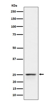 Anti-PEX11B Rabbit Monoclonal Antibody