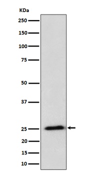 Anti-RPL10A Rabbit Monoclonal Antibody