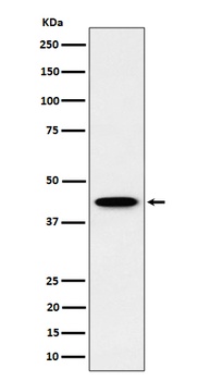 Anti-ITPK1 Rabbit Monoclonal Antibody