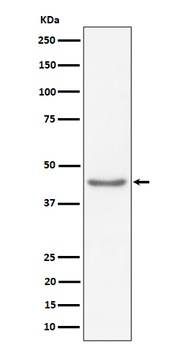 RBMXL2 Rabbit Monoclonal Antibody