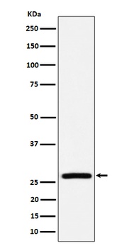 Anti-AK2 Rabbit Monoclonal Antibody