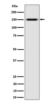 Anti-SLC12A1 / NKCC2 Rabbit Monoclonal Antibody