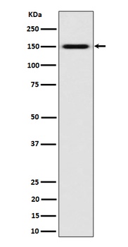 SLC12A1 / NKCC2 Rabbit Monoclonal Antibody