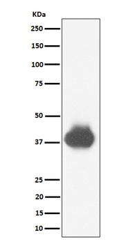 Anti-CD32A + CD32B + CD32C Rabbit Monoclonal Antibody