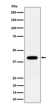 Anti-ACADS / SCAD Rabbit Monoclonal Antibody