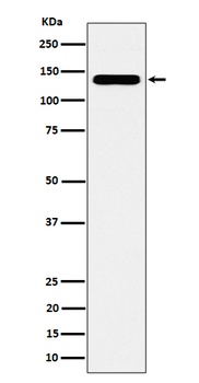 Anti-CYFIP1 Rabbit Monoclonal Antibody