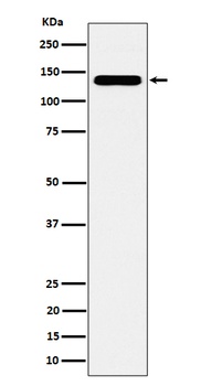 CYFIP1 Rabbit Monoclonal Antibody