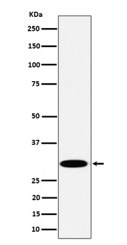 Anti-TPMT Rabbit Monoclonal Antibody