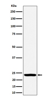 Anti-DTYMK Rabbit Monoclonal Antibody