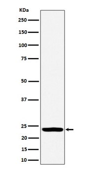 DTYMK Rabbit Monoclonal Antibody