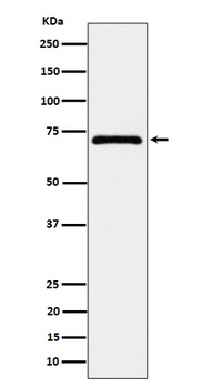 Anti-EPHX2 Rabbit Monoclonal Antibody