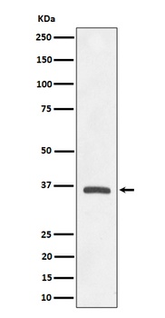 OXGR1 / GPR99 Rabbit Monoclonal Antibody