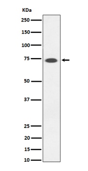 Anti-SSTR3 Rabbit Monoclonal Antibody