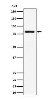 Anti-LTK Rabbit Monoclonal Antibody