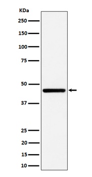 Anti-GNA13 Rabbit Monoclonal Antibody
