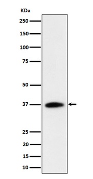 Anti-RASSF2 Rabbit Monoclonal Antibody