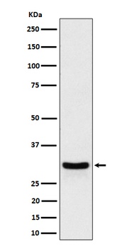 Anti-FRAT1 Rabbit Monoclonal Antibody