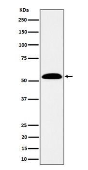 Anti-ALDH7A1 Rabbit Monoclonal Antibody