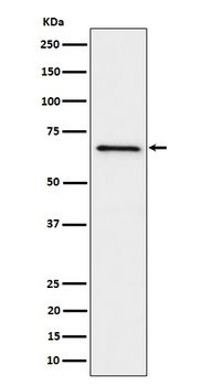 Anti-GRK6 Rabbit Monoclonal Antibody