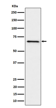 GRK6 Rabbit Monoclonal Antibody