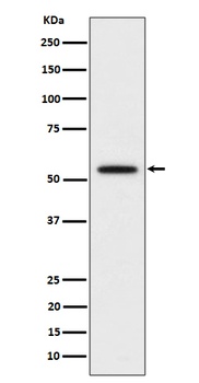 p60 katanin Rabbit Monoclonal Antibody
